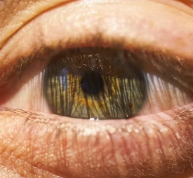 백내장 치료방법 진단 기준 예방법