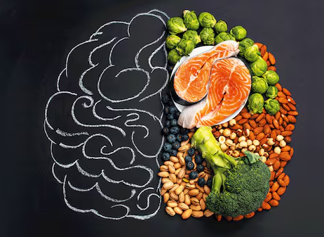 뇌졸중 뇌혈관질환 벼락두통 편두통 고혈압 뇌졸중예방 뇌건강 뇌동맥류 지주막하출혈 뇌건강식품