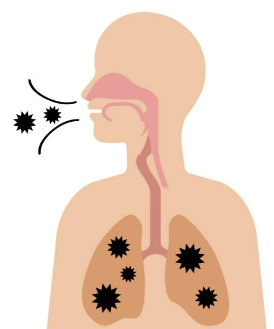 폐렴구균 예방접종 횟수 비용 무료 접종후 주의사항 총정리(최신 2024년)