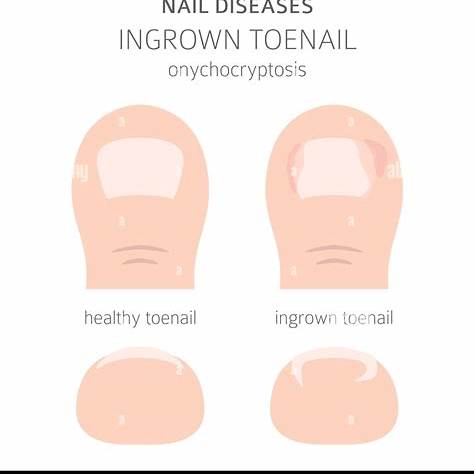 발톱 위생관리 체크리스트