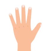 류마티스 관절염 초기 증상