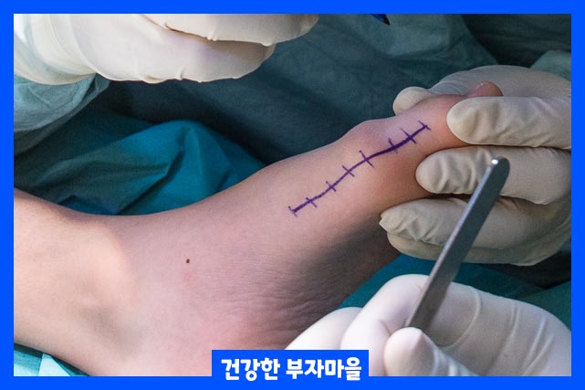 수술