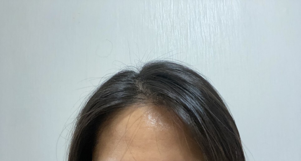 탈모샴푸 후기 찾고계신다면 확인