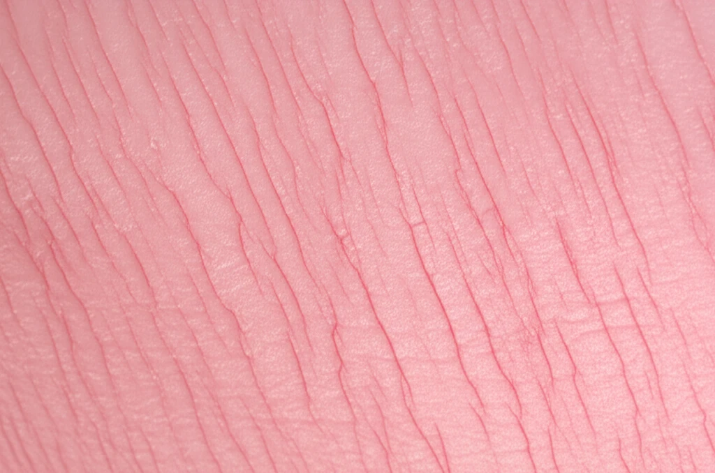 리프팅 흉터 고민 해결 시술 전후 관