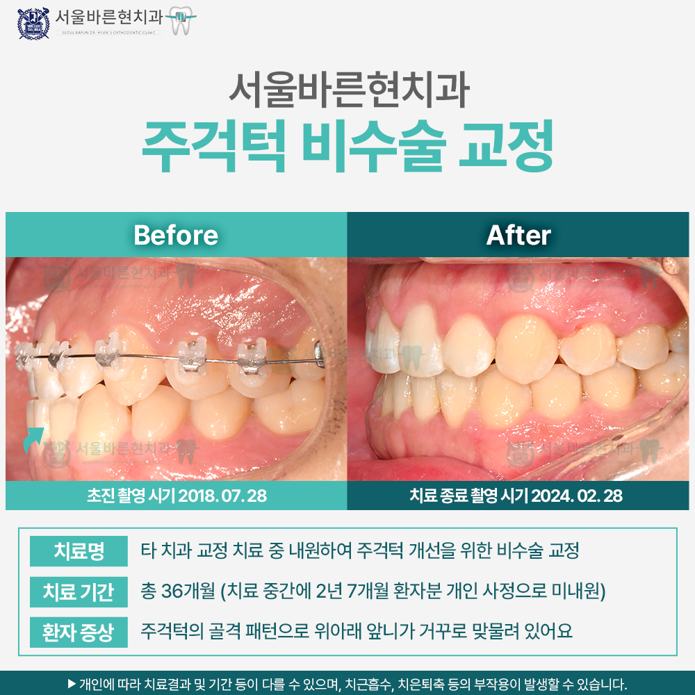 해운대교정치과