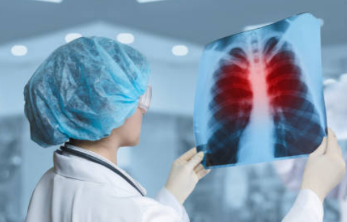 폐렴 증상, 전염성, 치료기간 총정리 (2025ver)