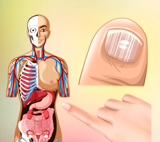 손톱에 세로줄이 생기는 이유