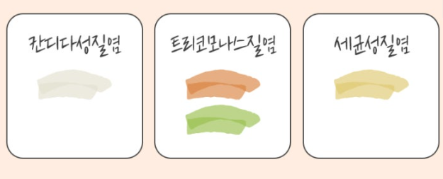 세균성 질염에 지노베타딘 질세정액 후기, 효과