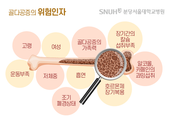 골다공증 위험인자