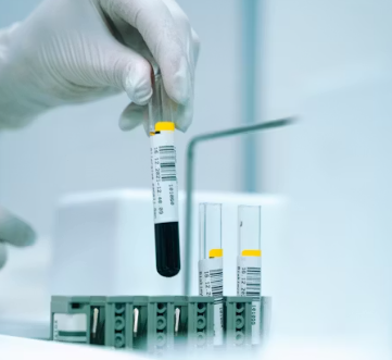 혈액순환 장애 증상 대처법