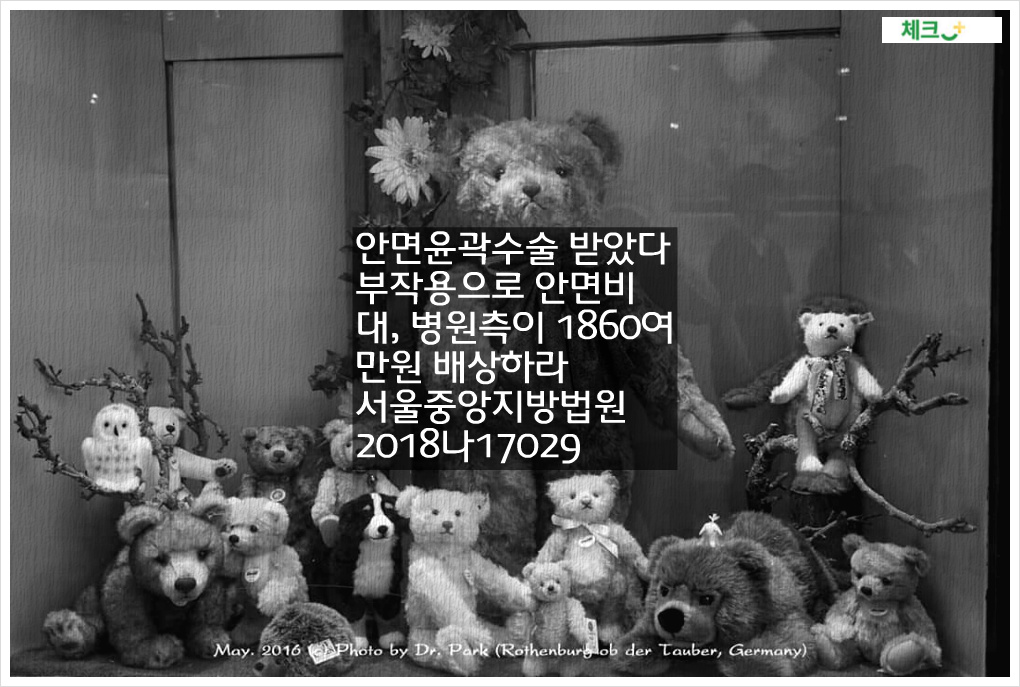 안면윤곽수술 받았다 부작용으로 안면비대, 병원측이 1860여만원 배상하라. 서울중앙지방법원 2018나17029 판결