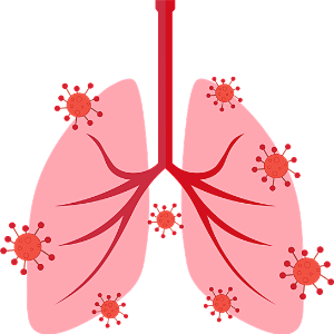 폐렴증상-이미지