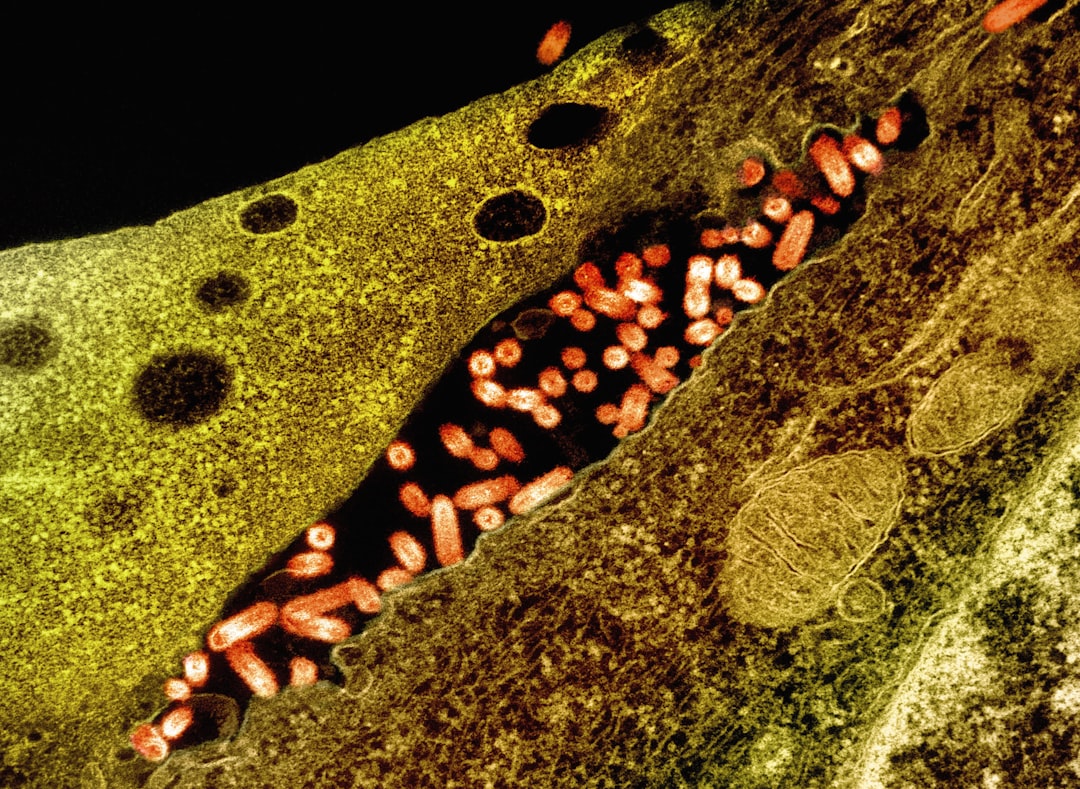 Stomatitis