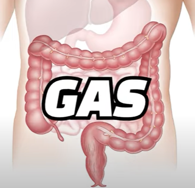 포드맵 음식을 먹고 가스가 차는 이미지