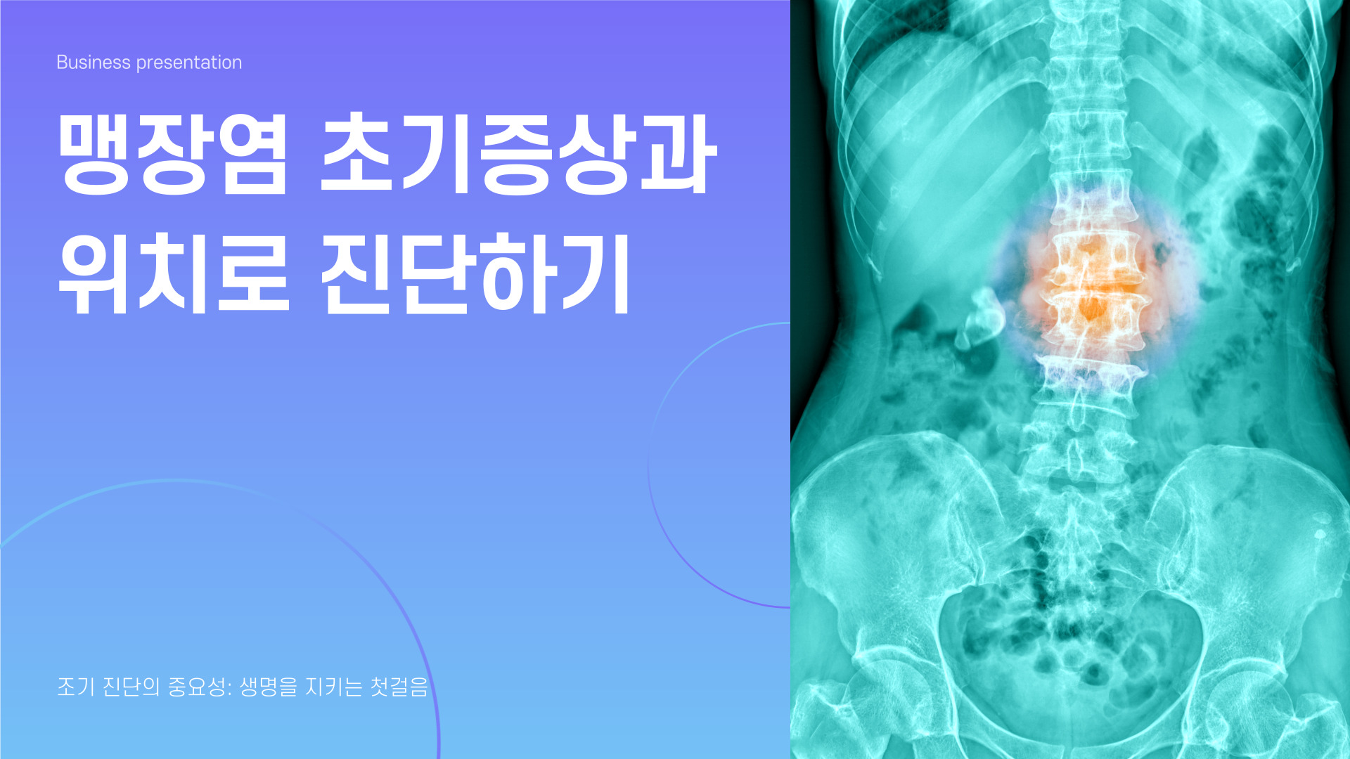 맹장염 초기증상과 위치