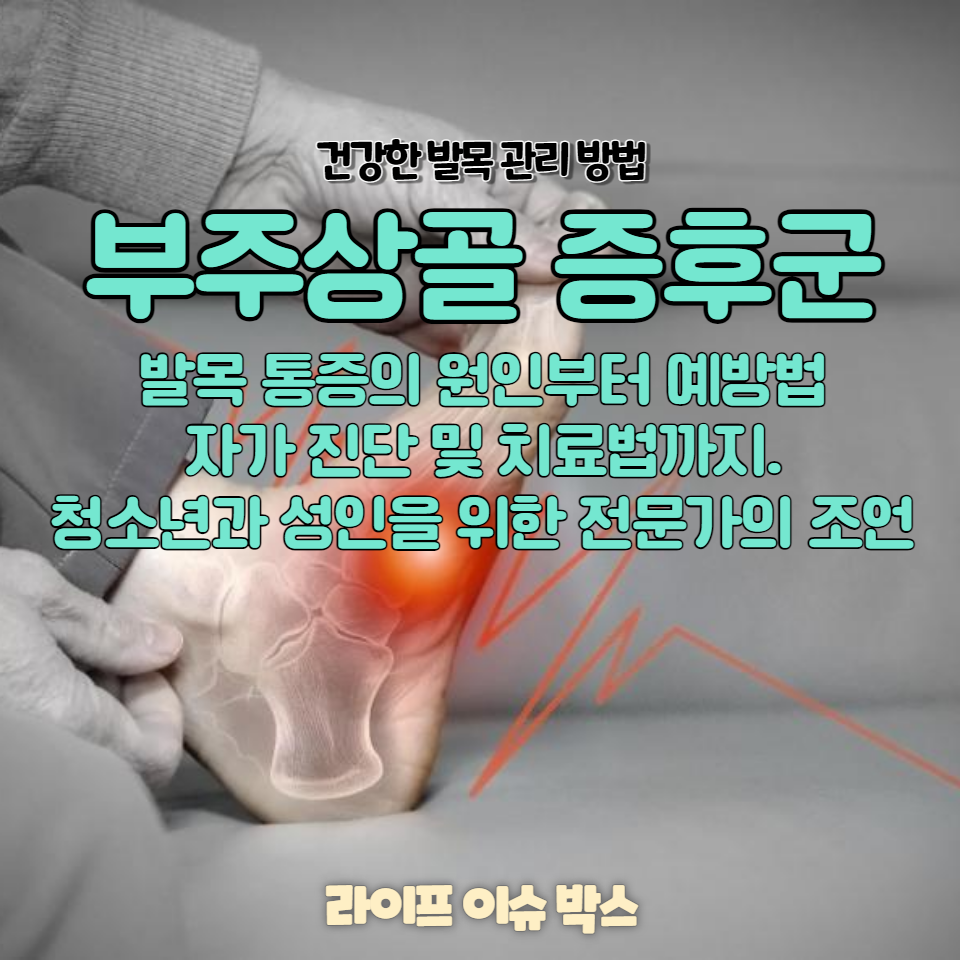 부주상골 증후군이란 무엇인가요?