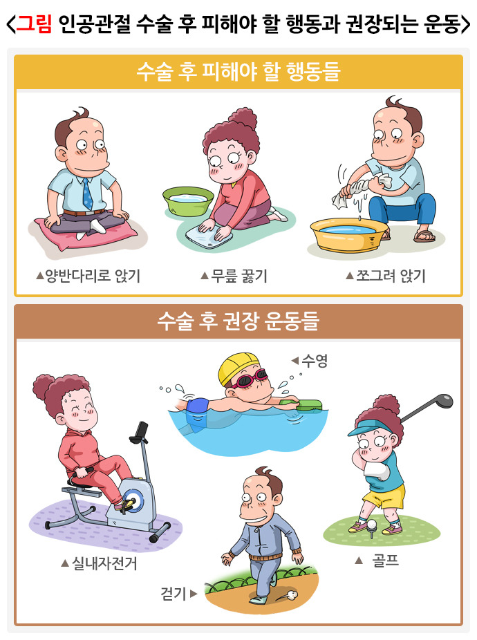 퇴행성관절염 원인, 증상, 예방, 치료방법