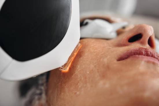 IPL(Intense Pulsed Light): 모공 관리와 피부 개선