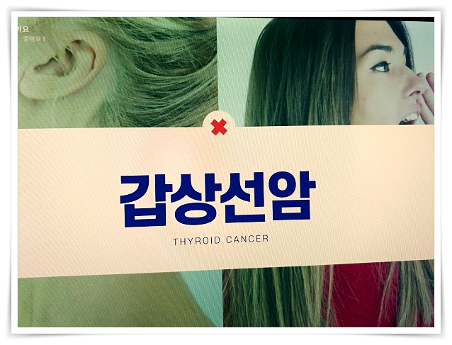 목에 가래낀 느낌