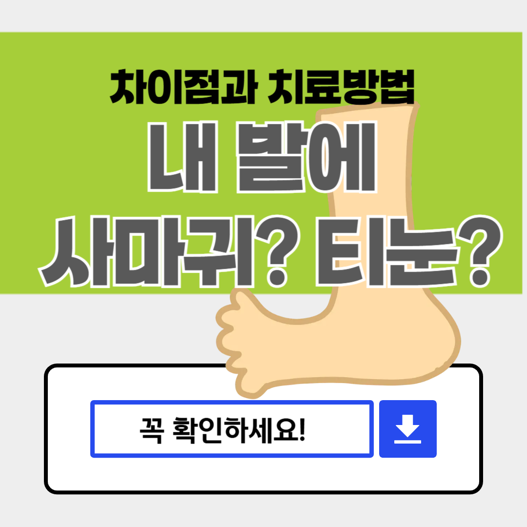 내 발에 사마귀? 티눈? 혼동될 때 알아야 할 차이점과 치료