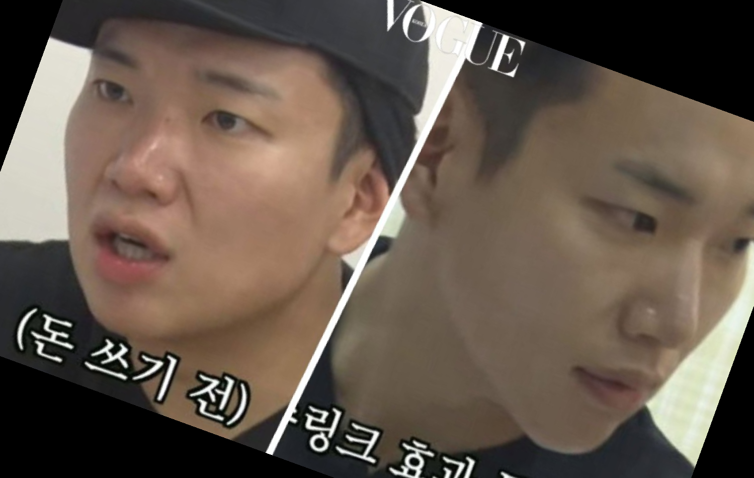 슈링크 부작용 효과 가격 후기