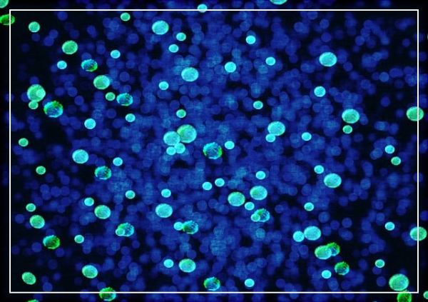 중년 여성 간암, 뜻밖의 원인 ‘B형 간염임을 보여주는 바이러스 이미지