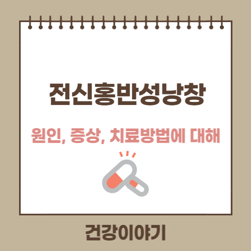 전신 홍반성 낭창(Systemic lupus erythematosus)에 대해