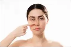 알레르기약&amp;#44; 증상별 약 알아보기