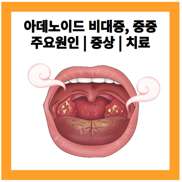 아데이노이드 중증