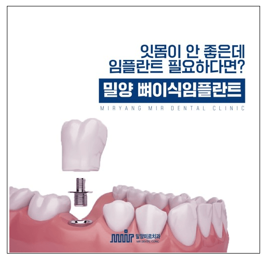 어버이날 선물 추천 : 임플란트(출처:밀양미르치과)