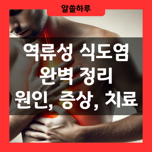 역류성 식도염 완벽정리