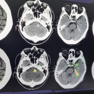 생성형 의료 AI 관련주 대장주 TOP5