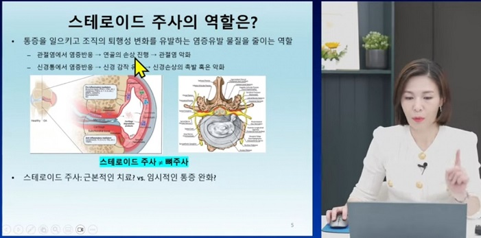 통증주사