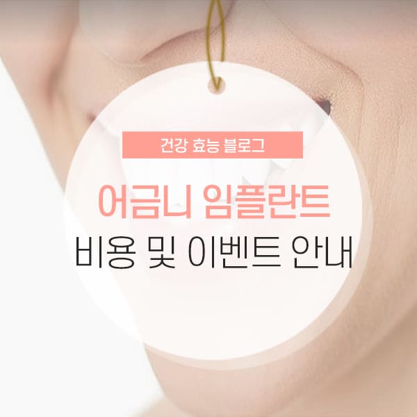 어금니 임플란트 비용 어금니 임플란트 비용 및 수술과정 소개 콘텐츠