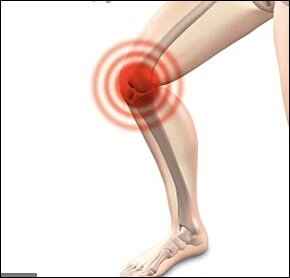 관절염에 좋은 운동 11