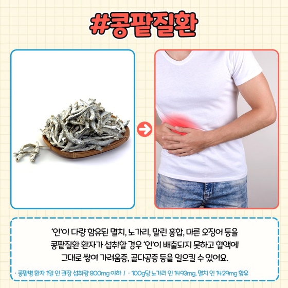 아플때 피해야하는 수산물, 콩팥질환, 멸치, 노가리, 말린홍합, 말린오징어