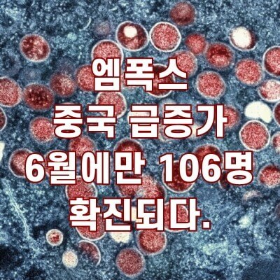  엠폭스 감염 경로