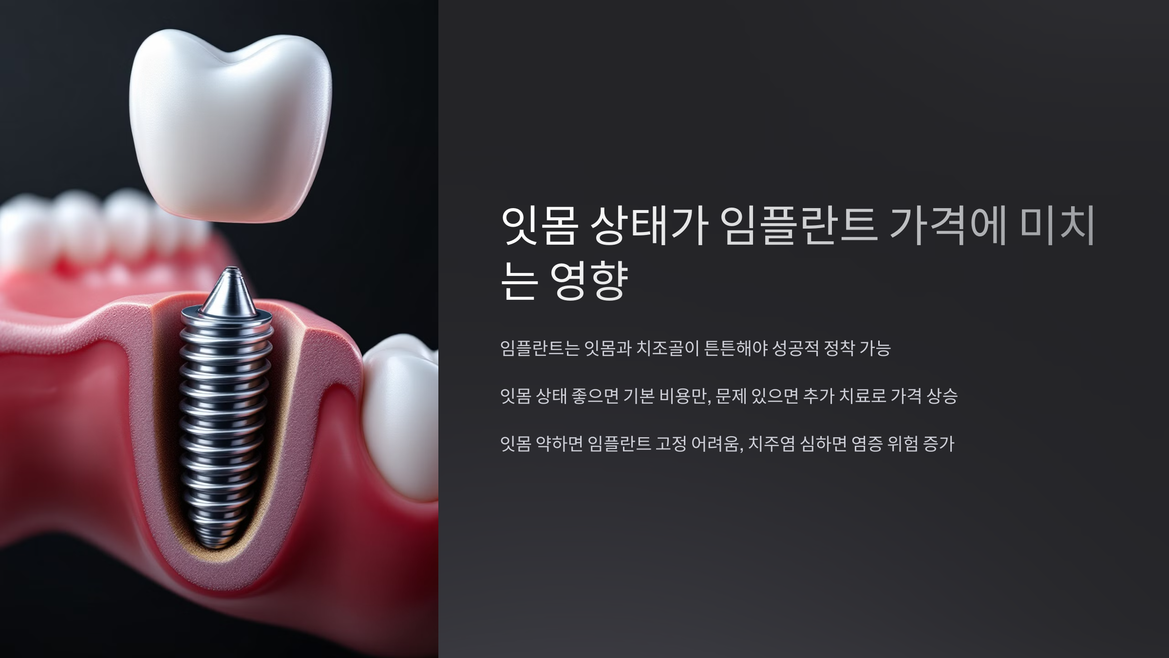 잇몸 상태가 임플란트 가격에 미치는 영향