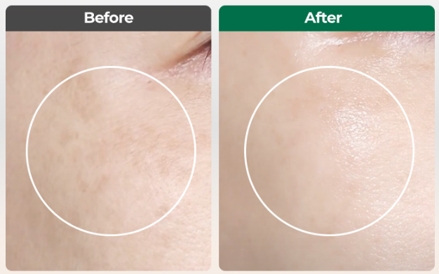 이지듀 기미앰플 효과