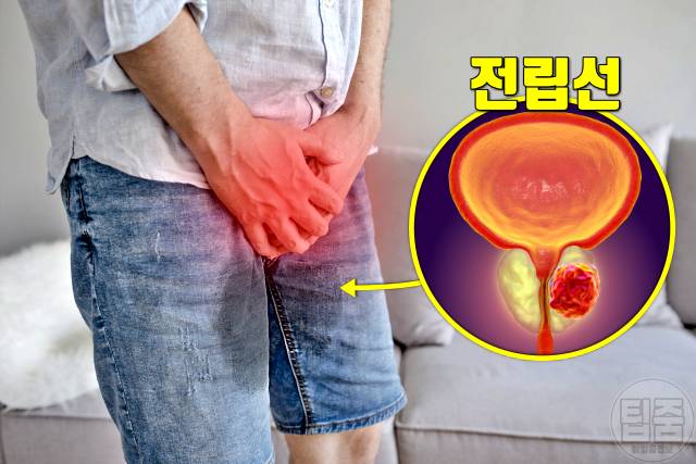 소변이 새요 요실금 원인 전립선
