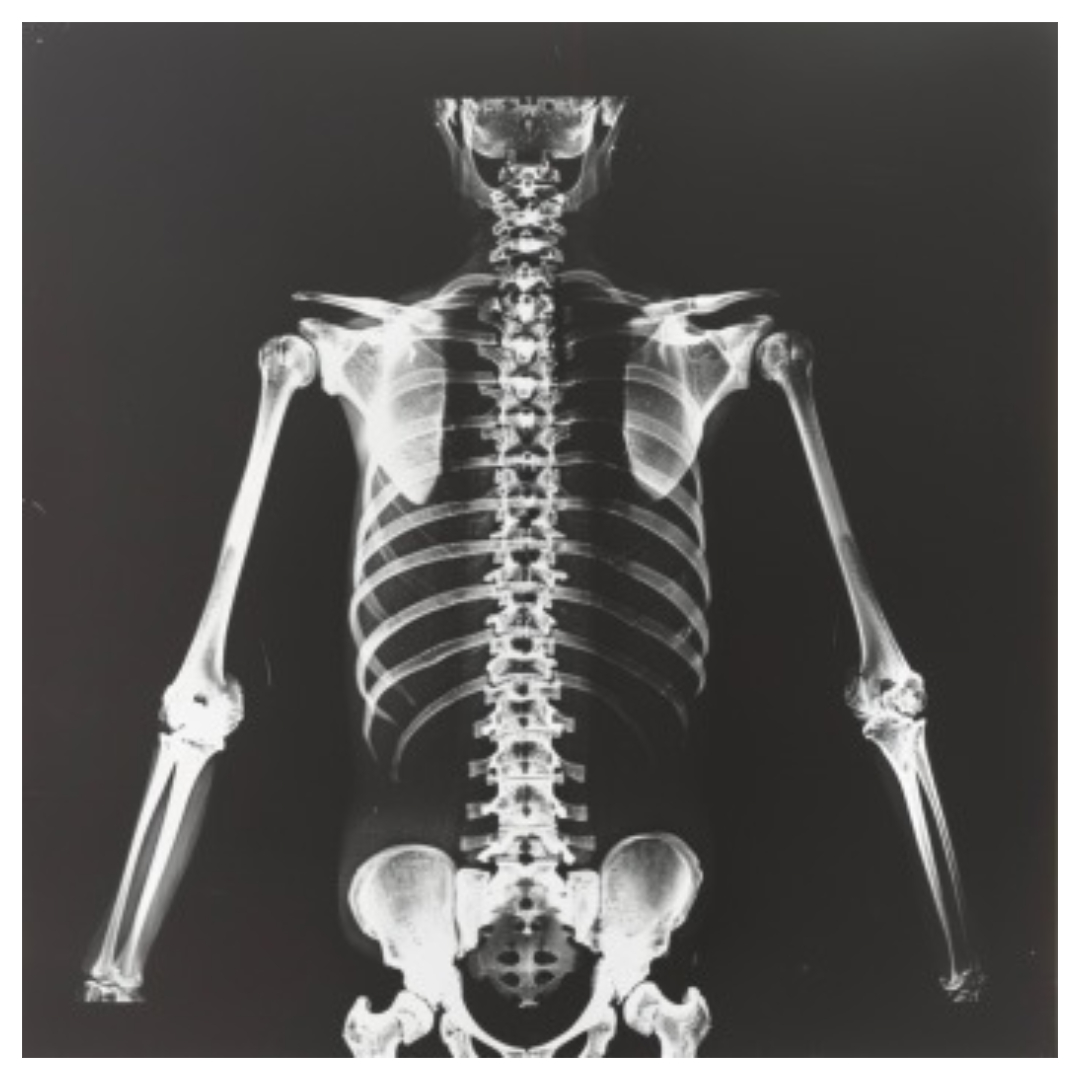 어깨통증과 관련된 사진입니다.