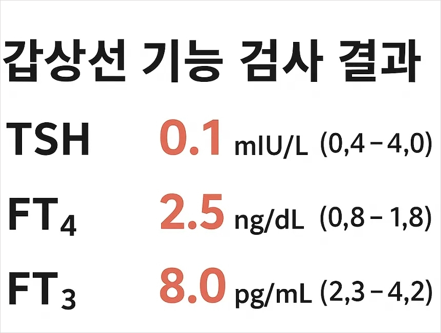 갑상선 기능 항진증 검사