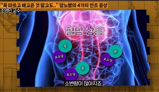 당뇨-명의-귀하신몸-조영민교수