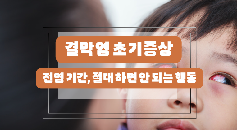 결막염 초기 증상과 전염 기간, 절대 하면 안 되는 행동