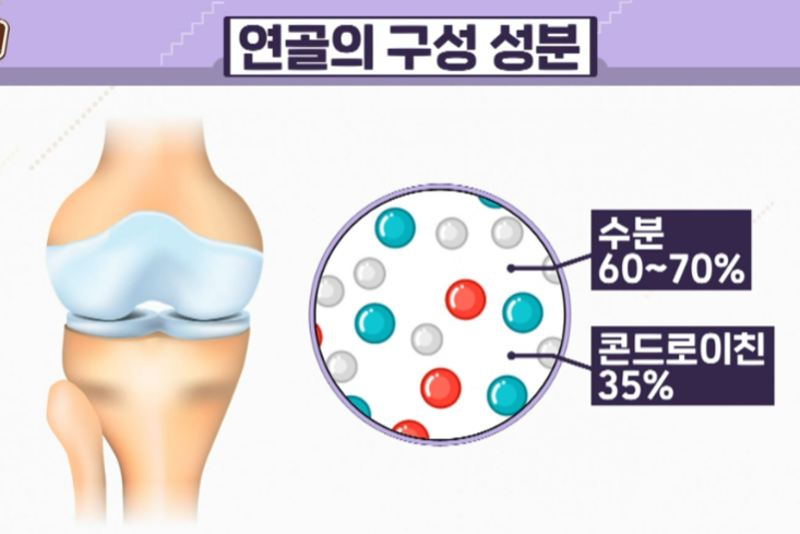 콘드로이친