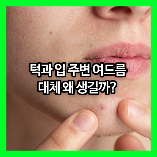 턱과 입 주변 여드름, 대체 왜? 성인 여드름의 숨겨진 원인과 해결책 총정리!