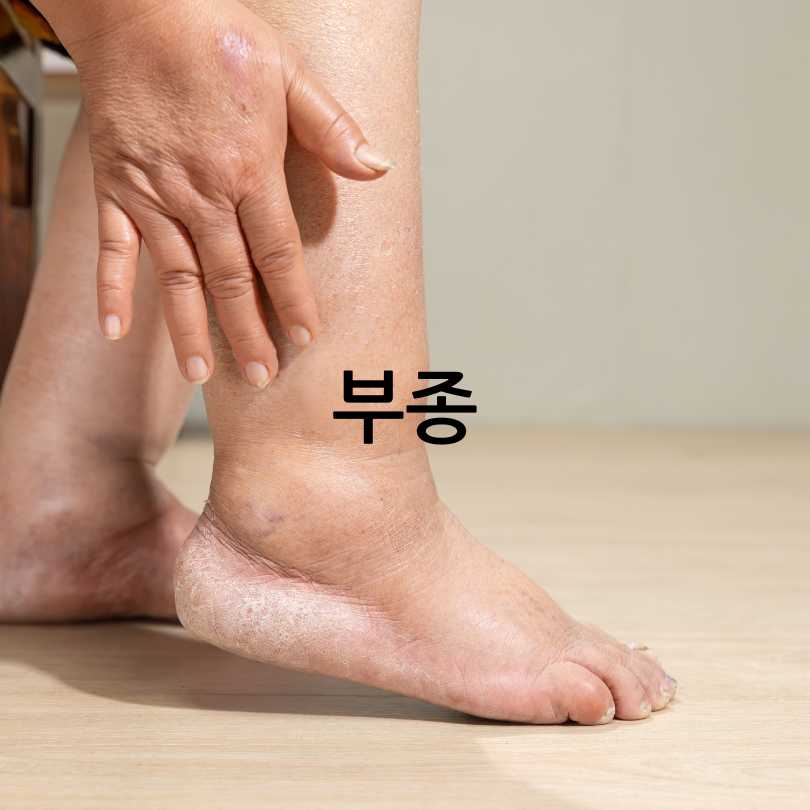 신장에좋은영양제