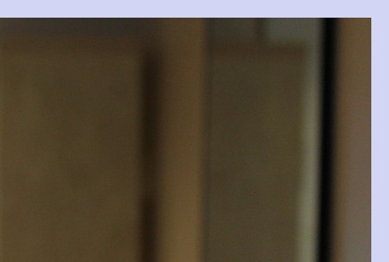 대상포진 치료기간