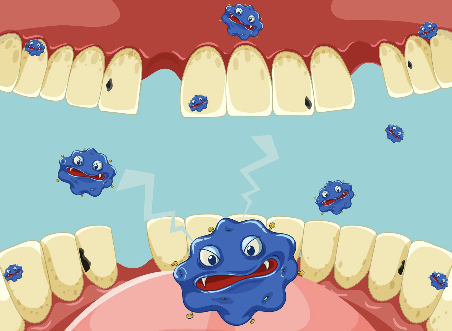 치주염 치료비용 치은염 차이 단계별 총정리