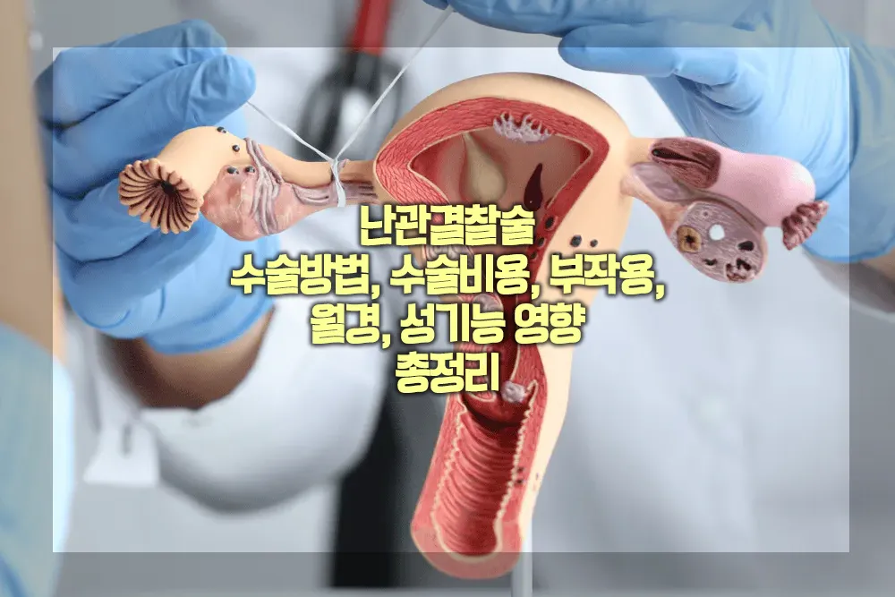 난관결찰술 수술방법 수술비용 부작용 월경 성기능 영향
